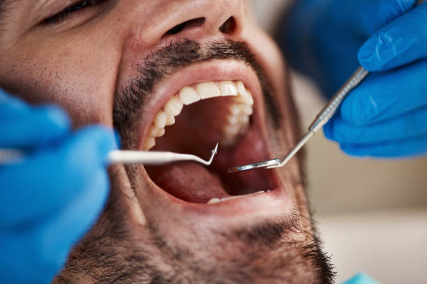 Best Emergency Treatment for Jaw Pain or Injury in Utica, NE
